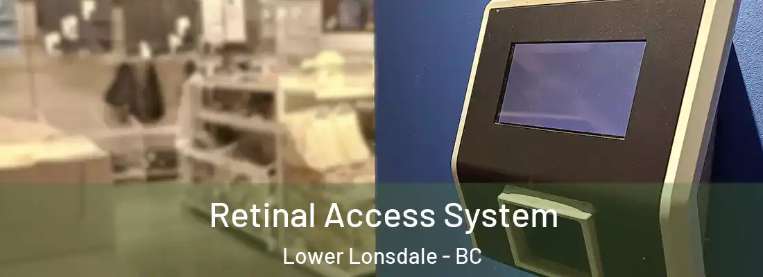  Retinal Access System Lower Lonsdale - BC